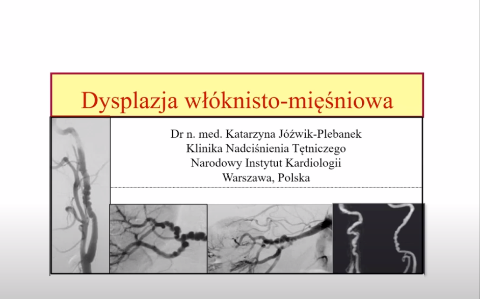 Polish - Dr. Katarzyna Jozwik-Plebanek