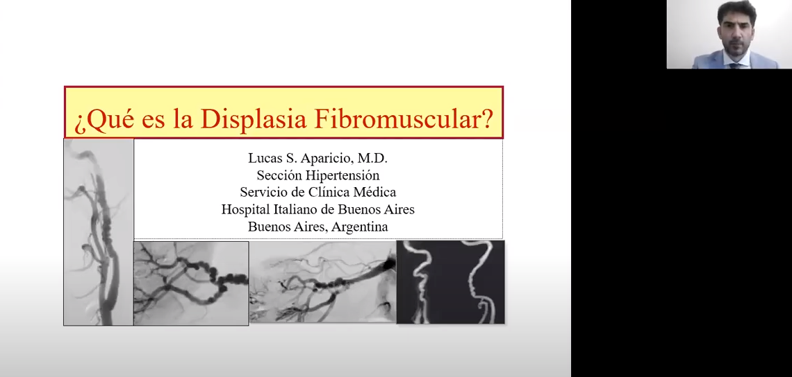 Spanish - Dr. Lucas Aparicio